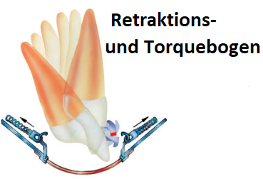 Retraktions- u. Torquebogen OK / UK 1 Stück 30° / 45° (210-3040)